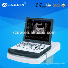 portable doppler ultrasound machine & laptop color doppler ultrasound scanner